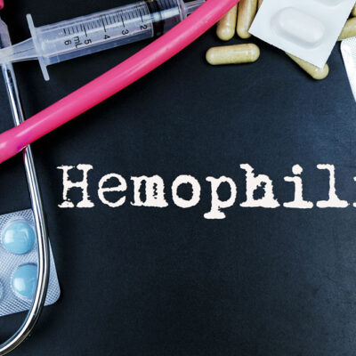5 Lifestyle Tips for Hemophilia Patients