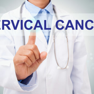 Common Risk Factors of Cervical Cancer