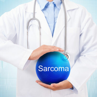 Common Types and Subtypes of Sarcoma