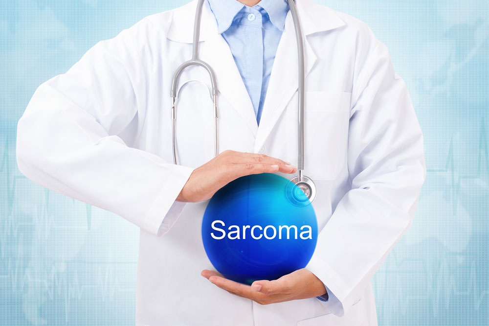 Common Types and Subtypes of Sarcoma