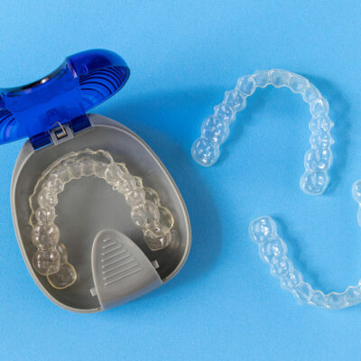 Pros and Cons Between Clear Aligners and Metal Braces