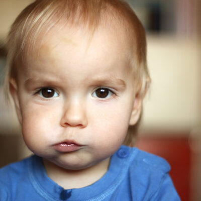 Foods That Trigger Hereditary Angioedema (HAE)