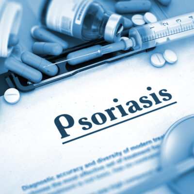 Foods To Avoid For Psoriasis And Treatment Options